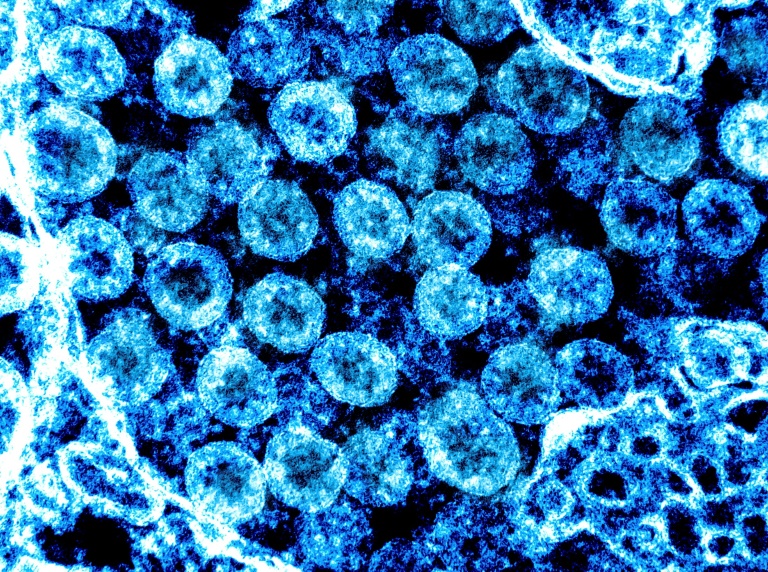 Abbildung von Coronaviren